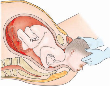 Normal vaginal delivery and maternity care