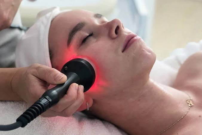 Radiofrequency Treatment